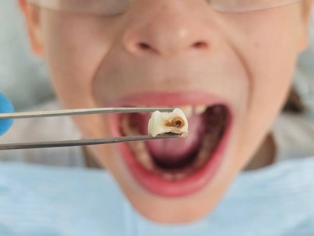 Best Same-Day Emergency Dental Services in Larksville, PA