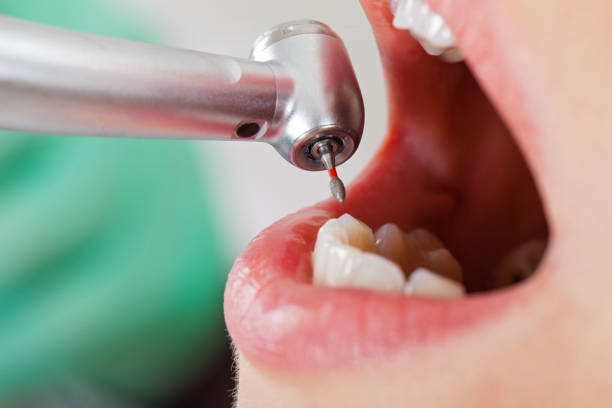 Best Emergency Root Canal Treatment in Larksville, PA
